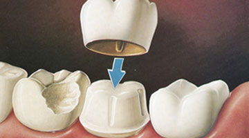 Goyal Dental Implants Clinic